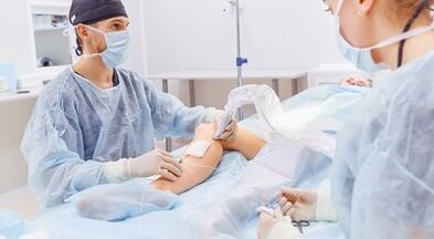 Varicose veins surgery
