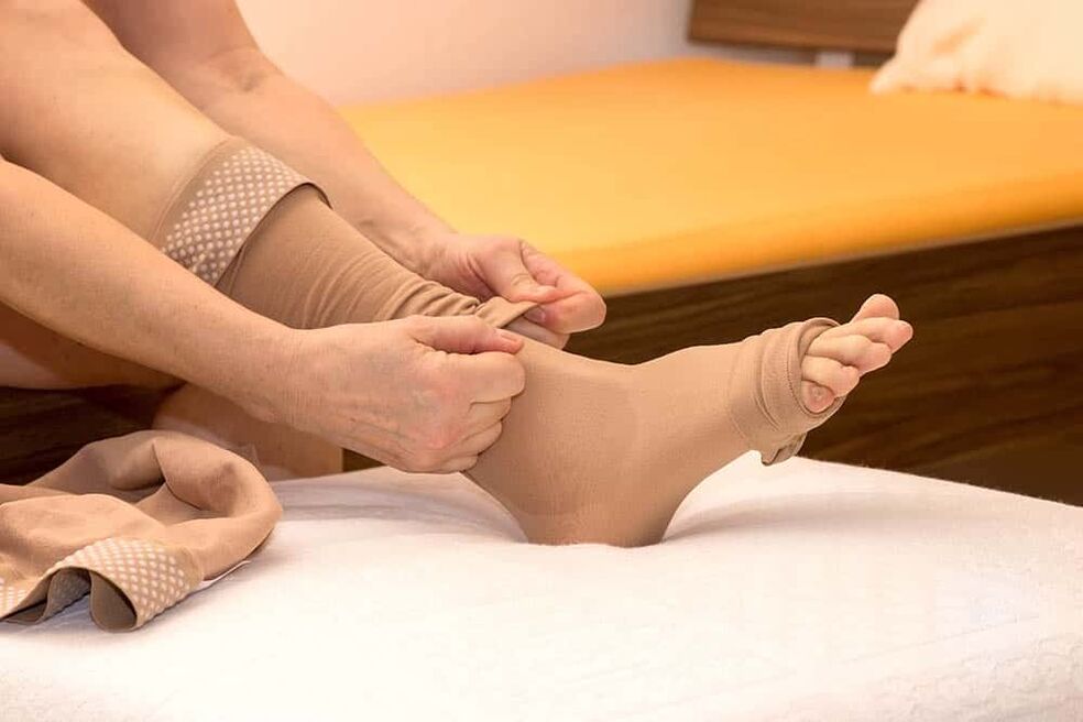 Wearing compression stockings will help relieve the manifestations of varicose veins. 