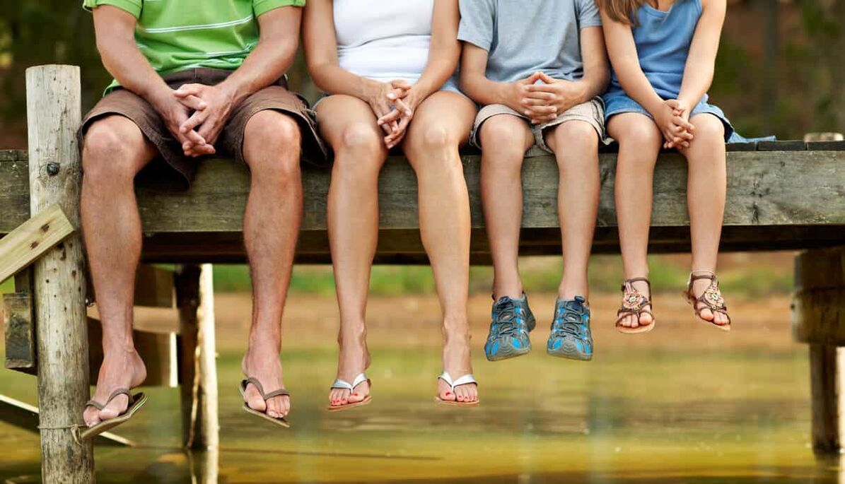 What matters is not where varicose veins come from, but how you personally treat them